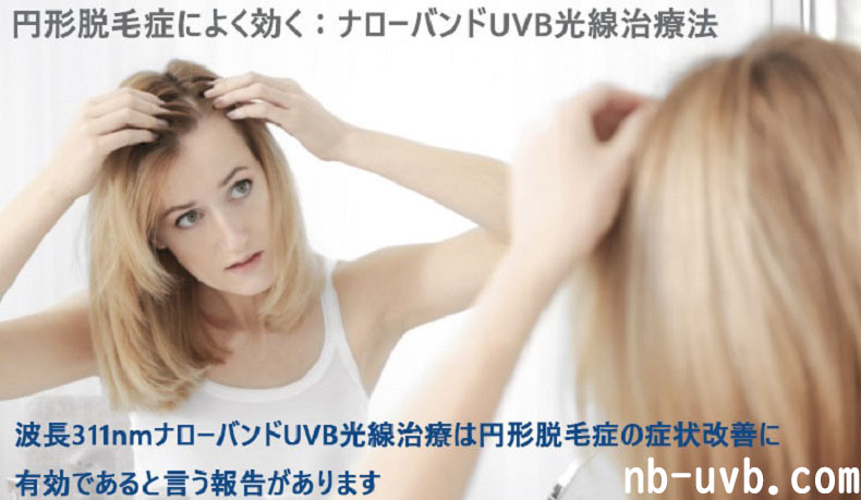 円形脱毛症によく効く：ナローバンドUVB光線治療